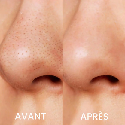 Masque Nasal + 180 Bandes à l’Aloe Vera - Élimination Express des Points Noirs